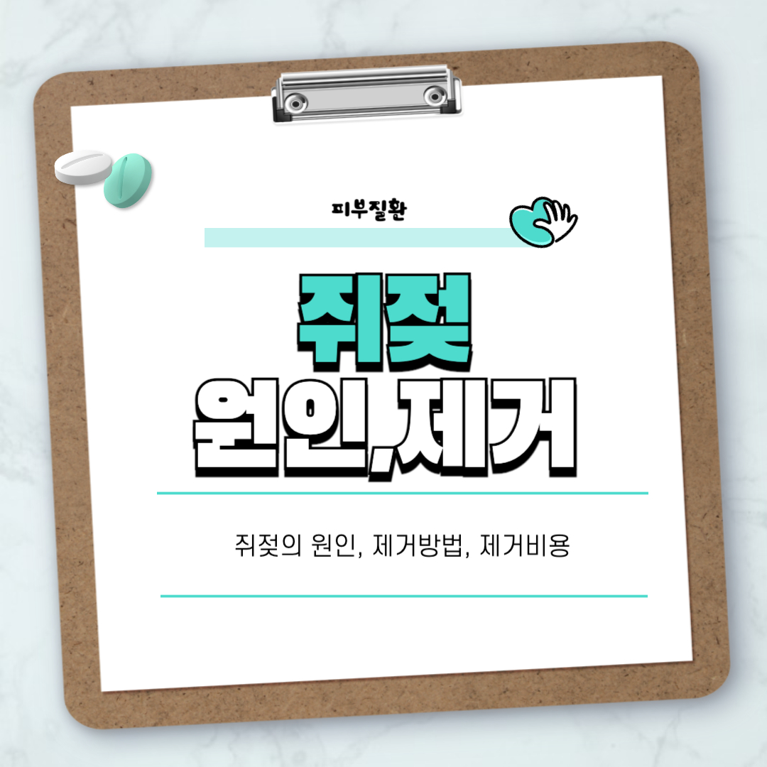 쥐젖