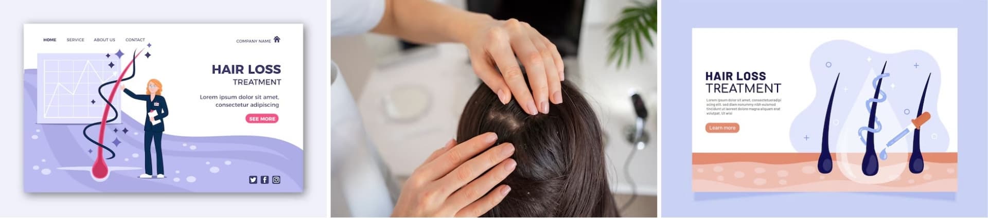 [탈모] 어느 병원 가야 할까? 치료 잘하는 전문 병원 전국 TOP 2