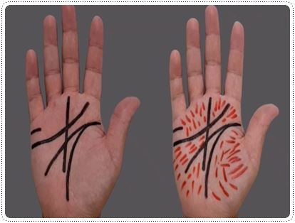 손금 잔선으로 성격 알아보기