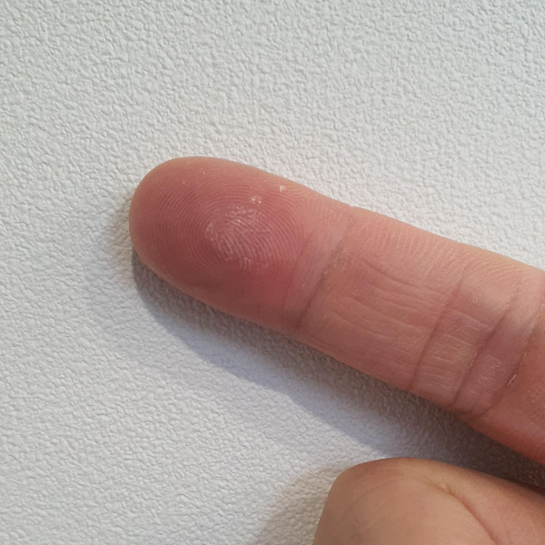 강력-순간접착제-지우는-방법