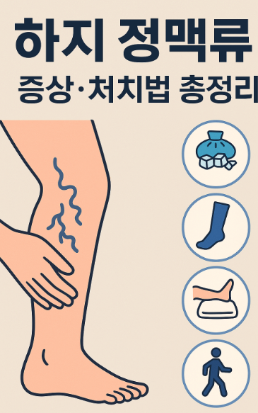 하지 정맥류 증상 처치법