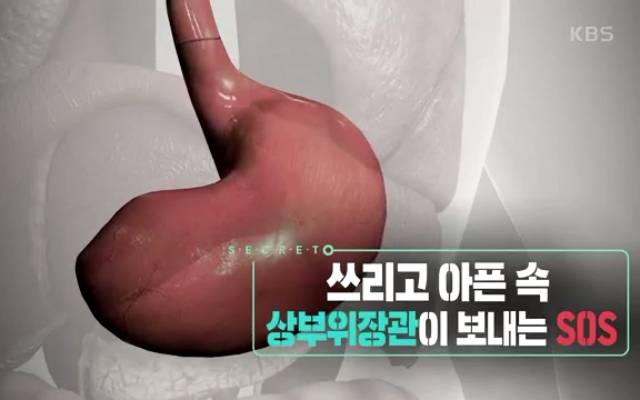 소화 안되고 트림 속쓰림 기능성소화불량 생로병사의비밀