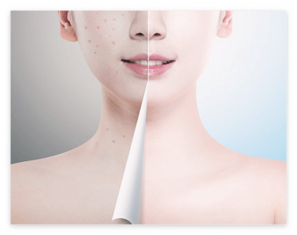 콘드로이친 효능