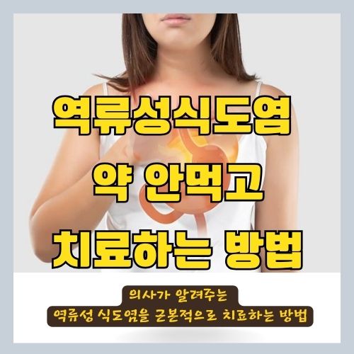 의사가 알려주는 역류성식도염을 병원 안가고 약 안먹고 고치는 방법 썸네일