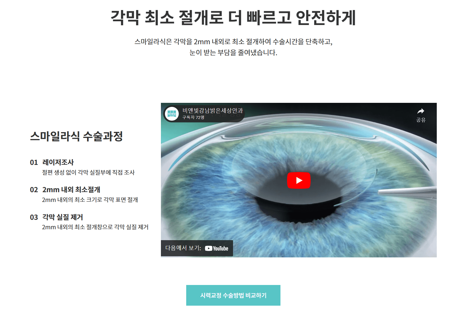 비앤빛-강남밝은세상안과-스마일라식-라섹-시술후기