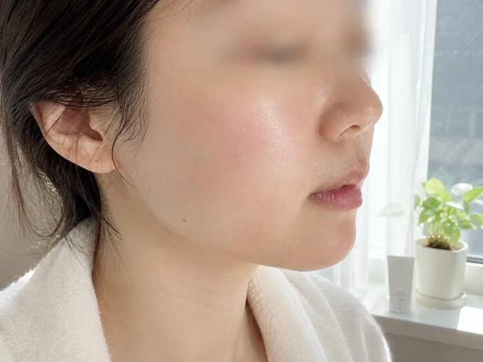 하얀색 샤워 가운을 입은 여성의 오른쪽 얼굴 측면 모습. 창가에서 들어오는 밝은 자연광을 받으며 세안 후 붉은 기 없이 매끄럽고 은은한 수분광이 도는 정돈된 피부결을 보여주는 사진. 배경으로 창틀 위에 작은 초록색 화분이 놓여 있는 일상 촬영 이미지.