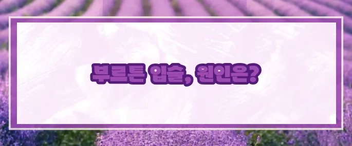 입술이 부르트는 이유 (+예방과 치료)