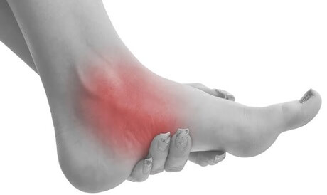 부주상골-accessaorynavicular