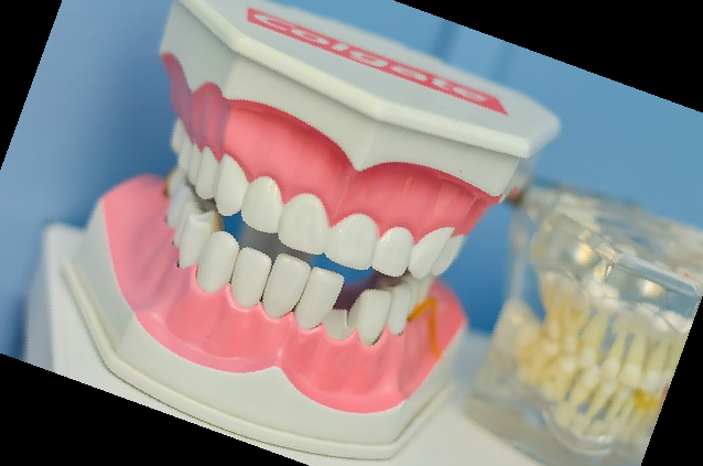 잇몸 내려앉음 치료