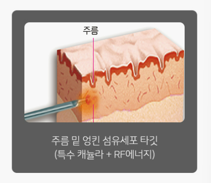 이노플러스