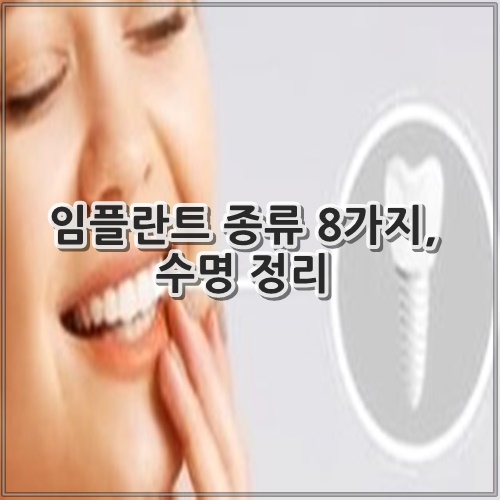 임플란트 종류 8가지, 수명 정리