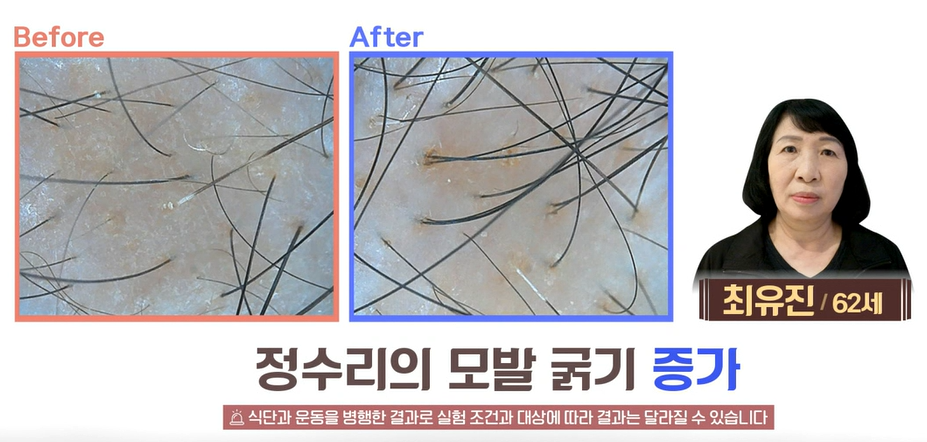 아누카사과효능