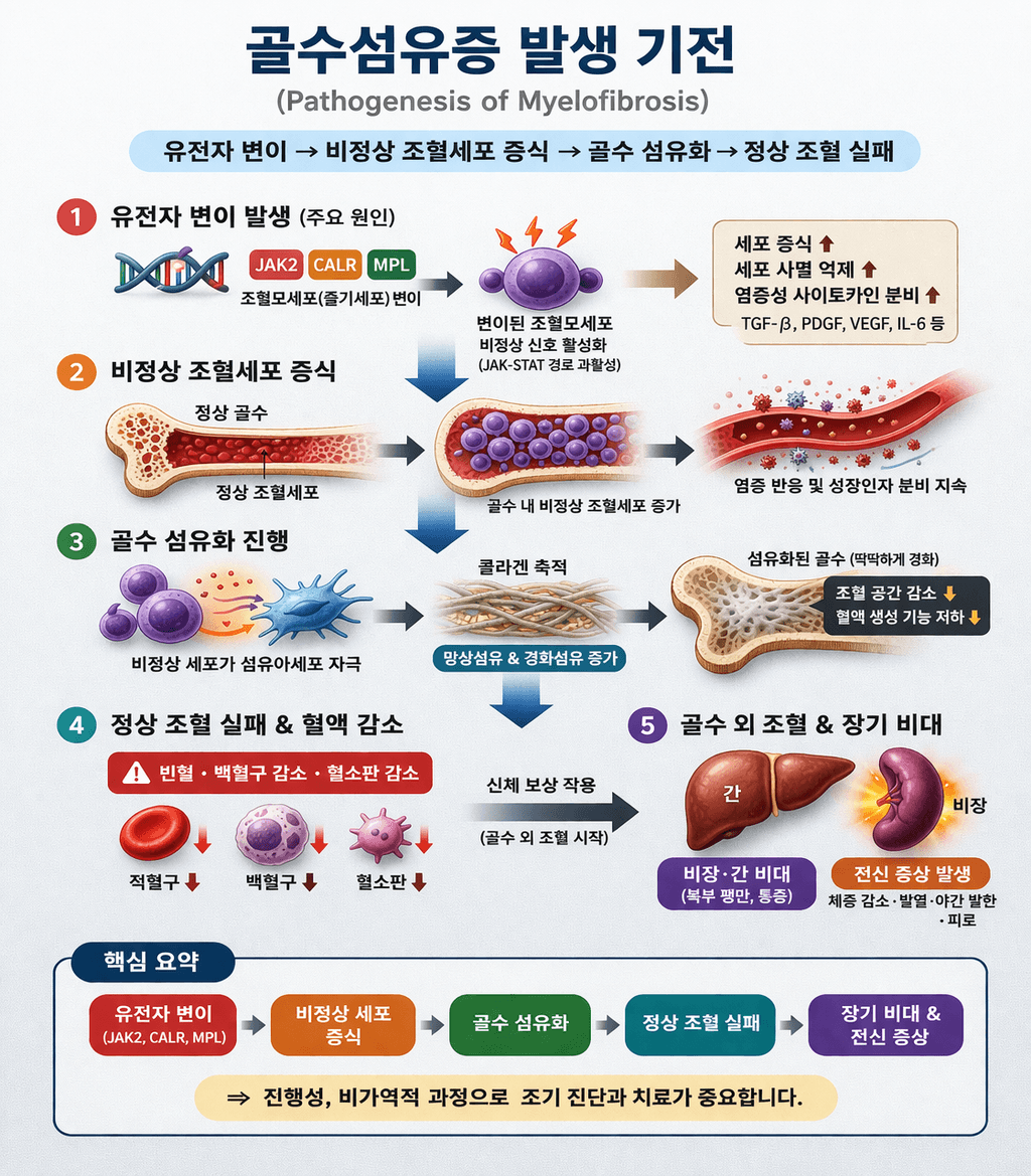 골수섬유증