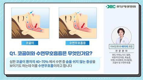 수면무호흡증