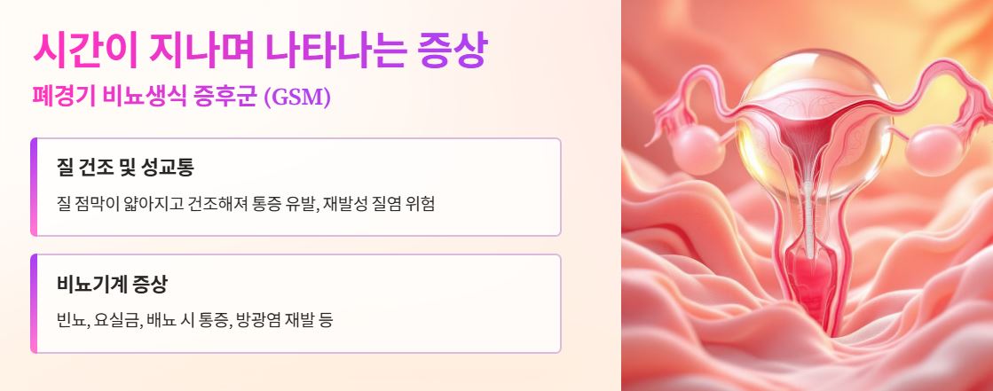 갱년기의 생식 증후군