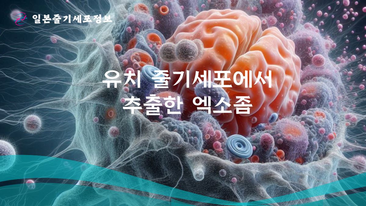 유치 줄기세포에서 추출한 엑소좀