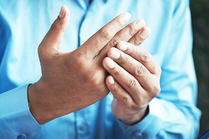 류머티스관절염-이미지