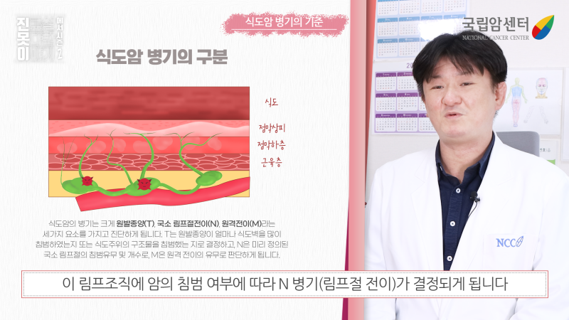 식도암