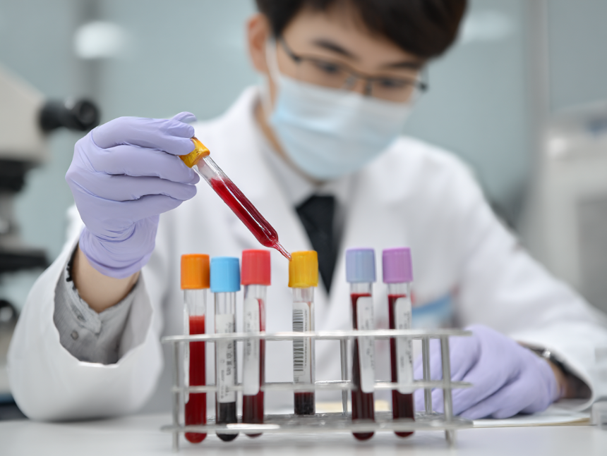 혈액검사
