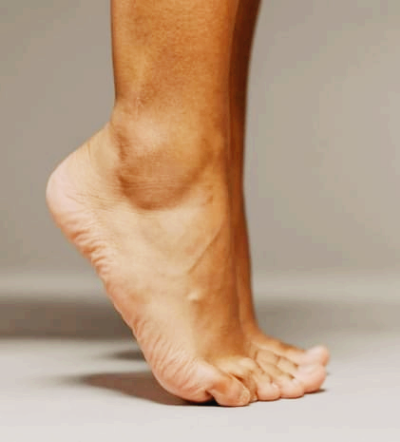 복숭아뼈 주위가 부어요, 단순한 부음일까? 물혹일까?