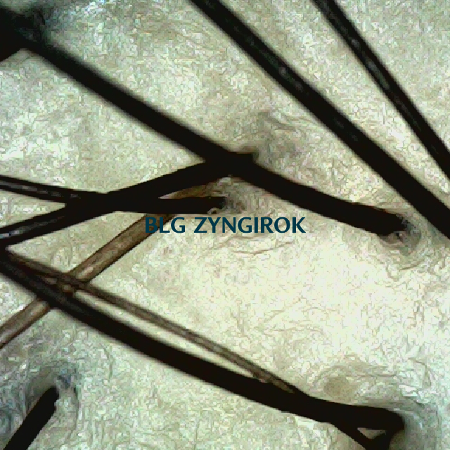 피나모아 복용 16주차 - 정수리 위치 두피 모습이다.