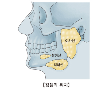 유행성이하선염이란?