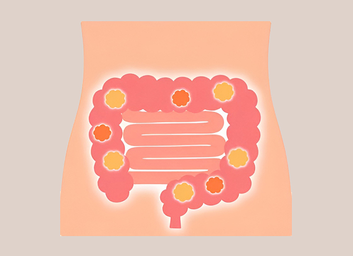 장-건강과-변비-예방