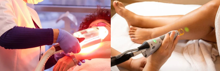 제모할 때 털 밀고 가야 할까요? 제모 시술 준비와 비용 1분 총정리