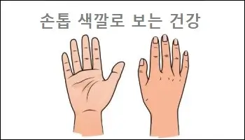 손톱 색깔로 보는 건강