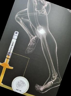 콘쥬란 주사 가격