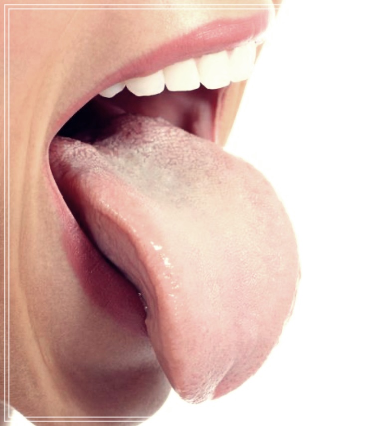 혀 갈라짐 원인 치료방법과 좋은 음식들