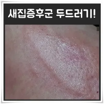 새집증후군 원인 제거 방법 포름알데히드 완전 가이드_25