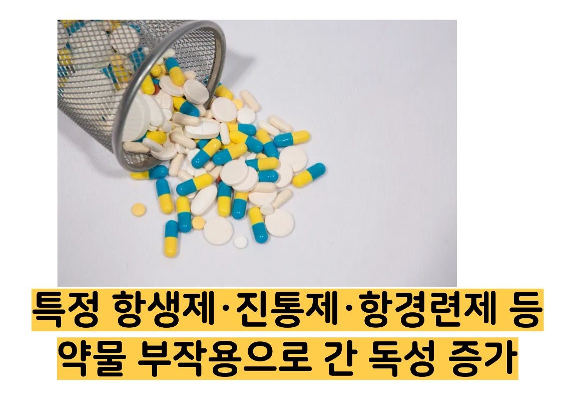 빌리루빈 수치상승 원인