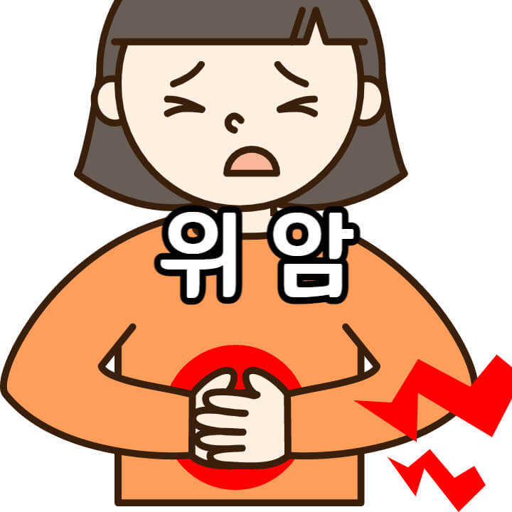 위암-대표사진