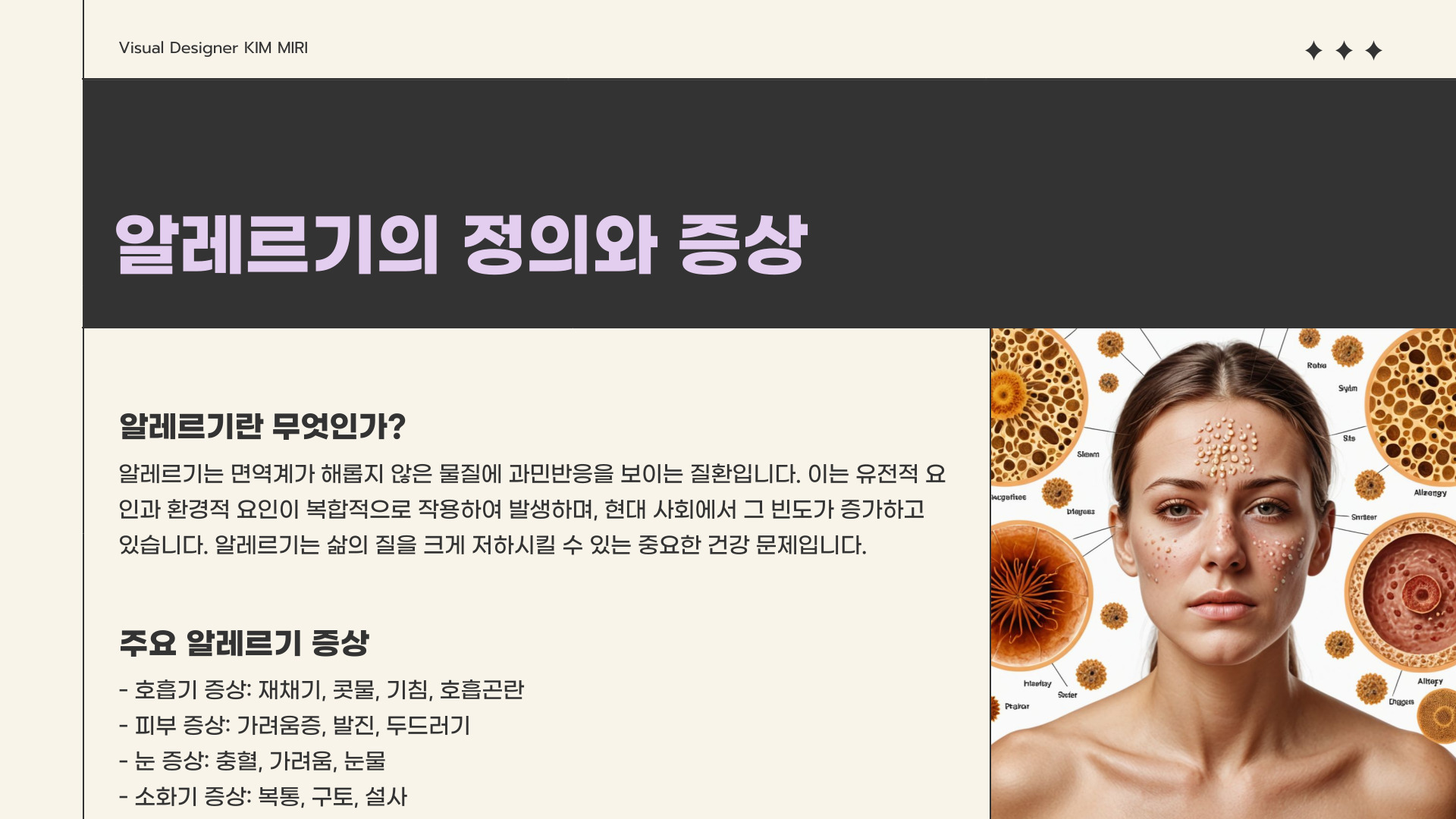 알레르기검사