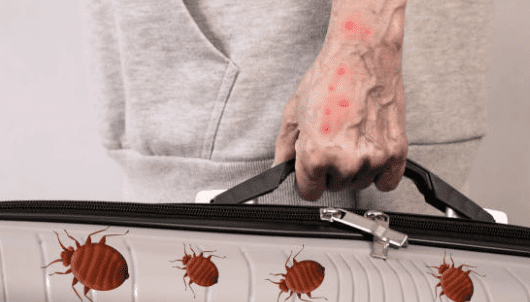 빈대 물린자국 빈대 퇴치법 퇴치제 살충제