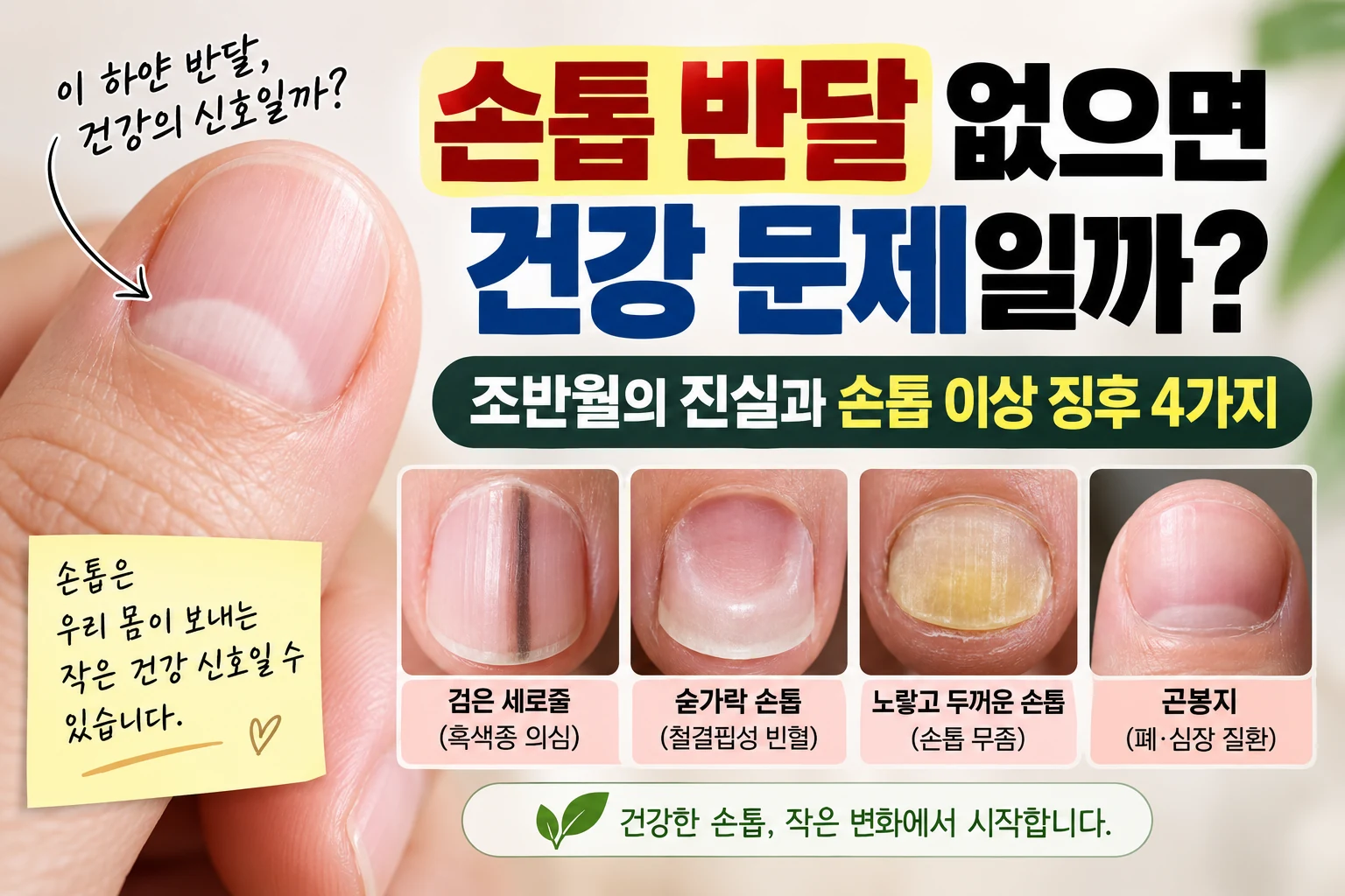 손톱 반달(조반월) 건강 상태 확인과 손톱 이상 징후 4가지 안내 썸네일