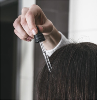 탈모는 치료가 필요하다