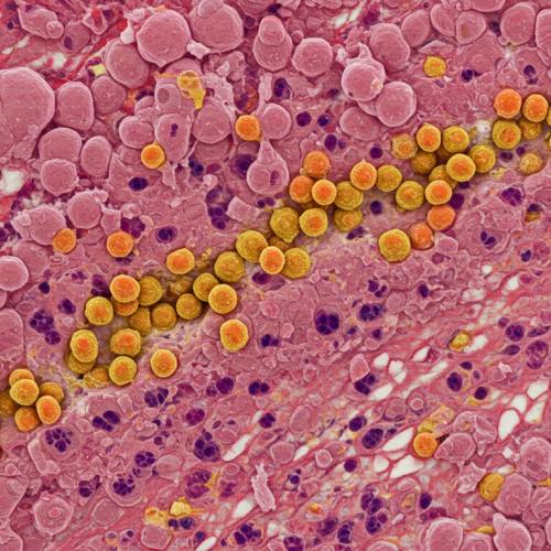 콘드로이친 부작용