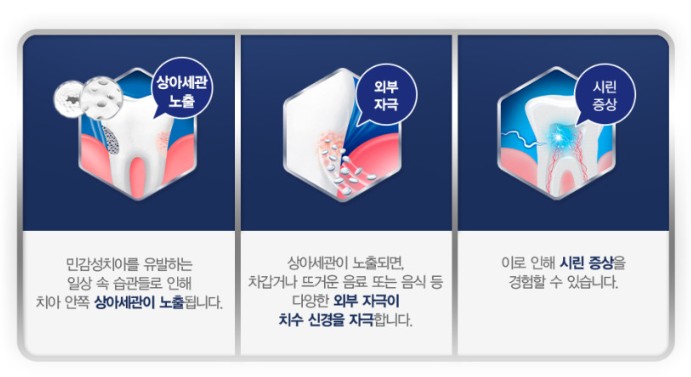 치아가-예민해지는-원인을-자세하게-설명해주고-있습니다.