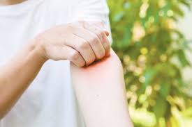 온몸이 가려운 증상