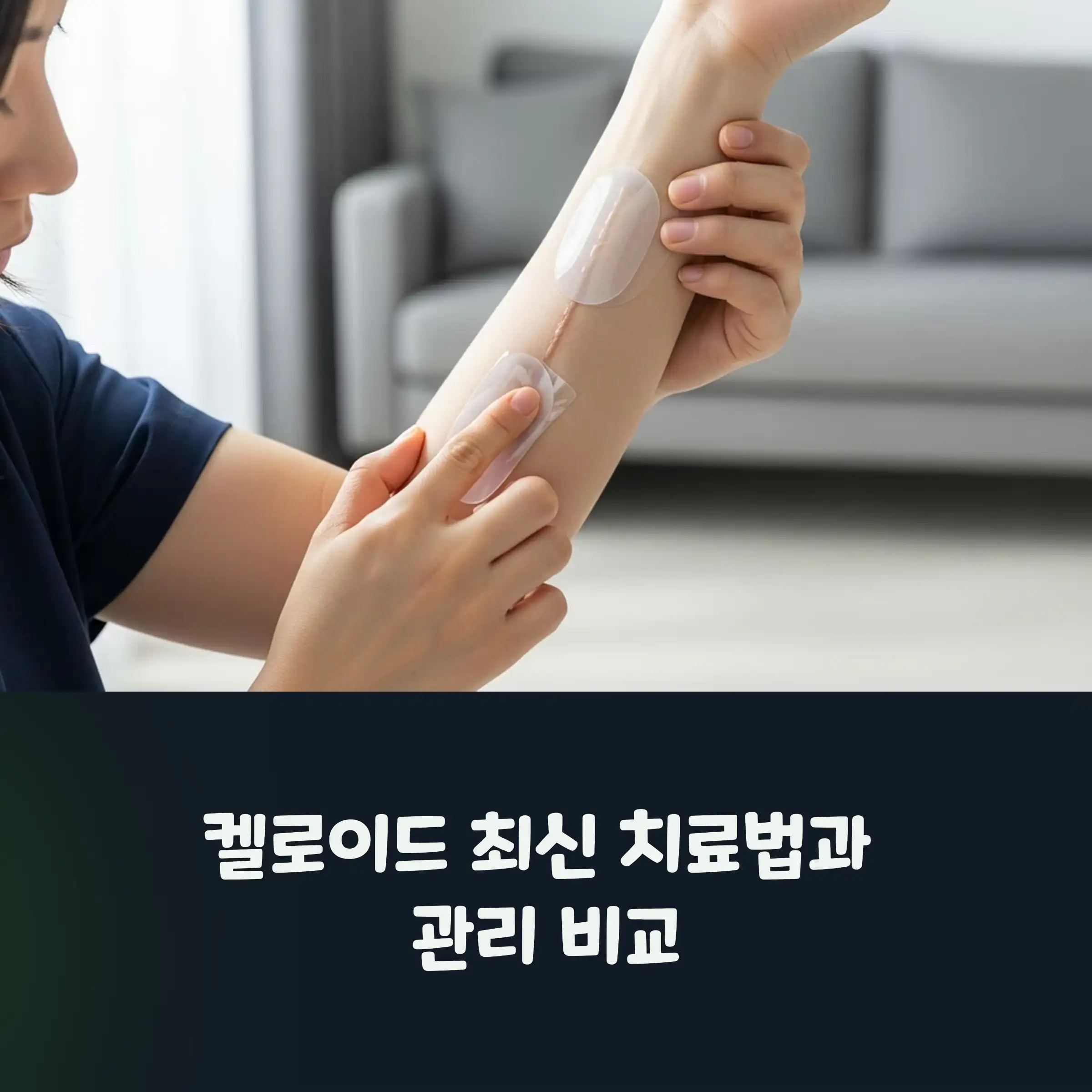 켈로이드 최신 치료 방법