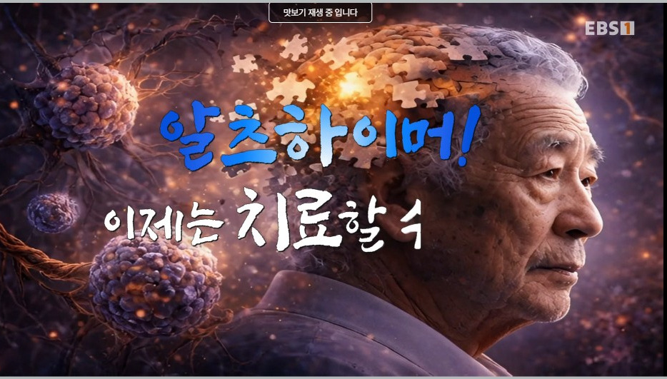 최성혜교수 EBS 명의 알츠하이머 치매 신경과 병원 치료방법