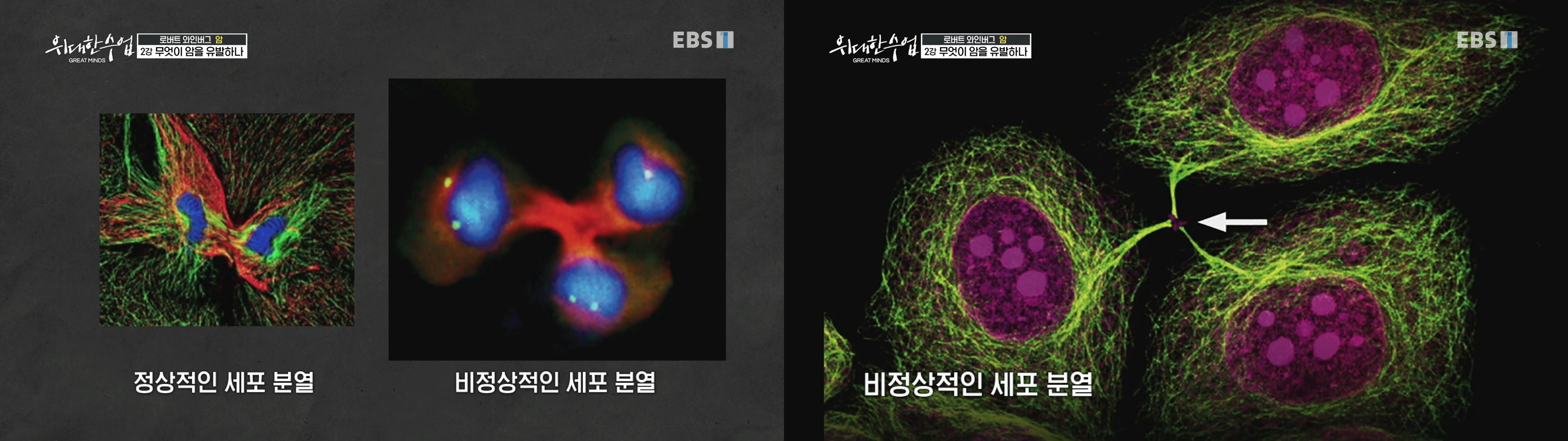 비정상적인 세포 분열