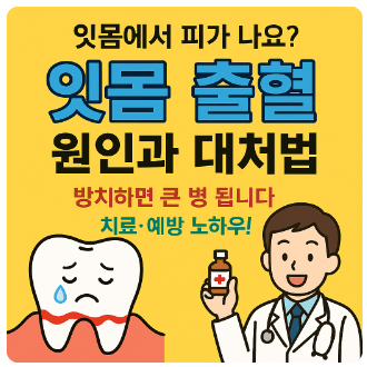 잇몸출혈대처법