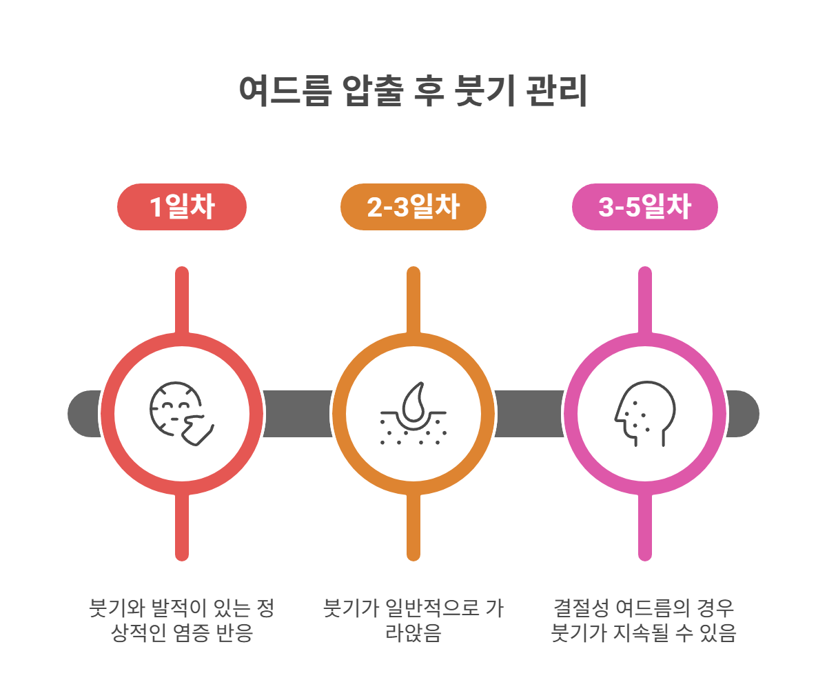 여드름 압출 후 붓기, 왜 생길까?