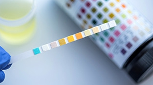 소변색깔이 노란색 원인