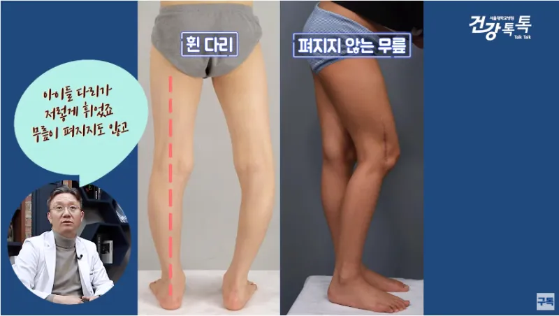 성장판 닫혀도 키 클 수 있는 방법과 성장 호르몬 시기_5