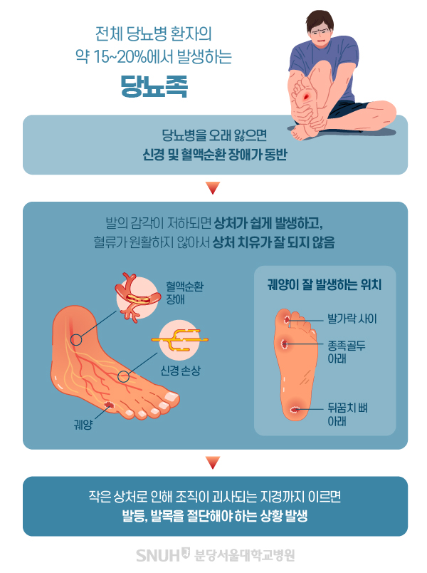 당뇨족 발관리
