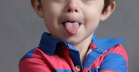 혀가 보내는 이상 신호? 혀질환이 보내는 몸속 이상 신호